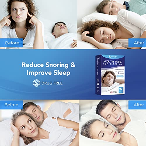 Skyloa Mouth Tape for Sleeping, Advanced Sleep Strips, Sleep Mouth Tape